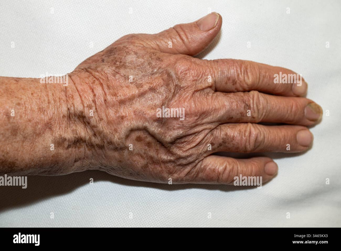 Taches de vieillesse et texture de peau ridée sur la main de la vieille femme. Banque D'Images