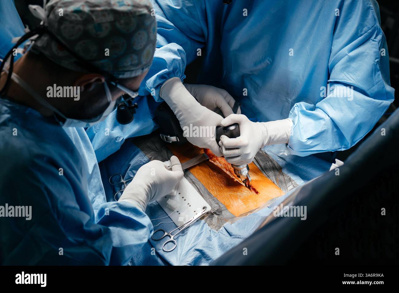 Gros plan équipe diversifiée de chirurgiens pratiquant la chirurgie sur un patient dans la salle d'opération de l'hôpital. Traitement urgent, chirurgie plastique. Banque D'Images