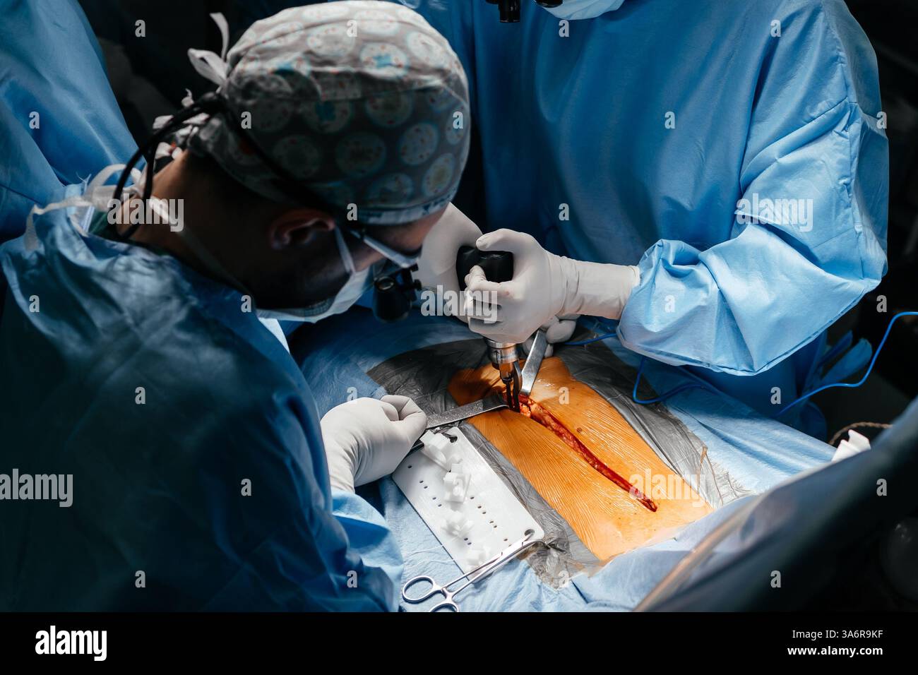 Gros plan équipe diversifiée de chirurgiens pratiquant la chirurgie sur un patient dans la salle d'opération de l'hôpital. Traitement urgent, chirurgie plastique. Banque D'Images