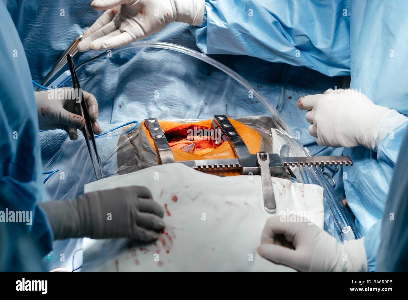 Gros plan sur l'équipe de chirurgie opérant dans un hôpital moderne. Les travailleurs médicaux travaillent en équipe, sauvant la vie du patient en sauvant la chirurgie plastique cardio Banque D'Images