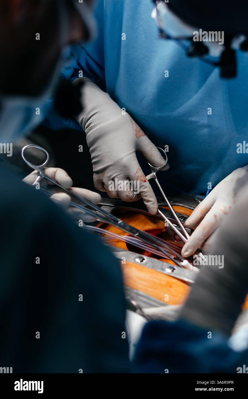 Équipe chirurgicale opérant un patient à l'hôpital. Santé et concept médical. Les médecins effectuent une opération cardiaque. Prise de vue verticale Banque D'Images