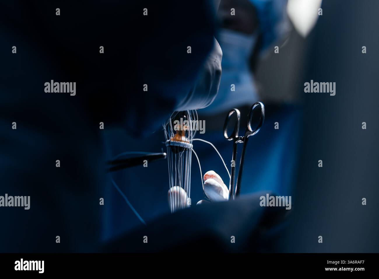 Équipe de chirurgiens expérimentés effectuant une opération cardiaque complexe avec une concentration totale dans une salle d'opération bien éclairée. La technologie en cardiologie Banque D'Images