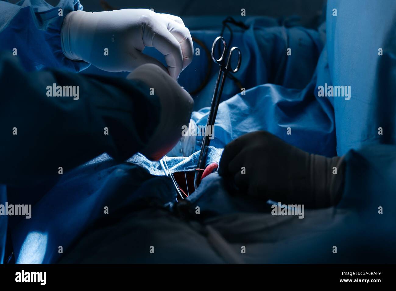 Équipe de chirurgiens expérimentés effectuant une opération cardiaque complexe avec une concentration totale dans une salle d'opération bien éclairée. La technologie en cardiologie Banque D'Images