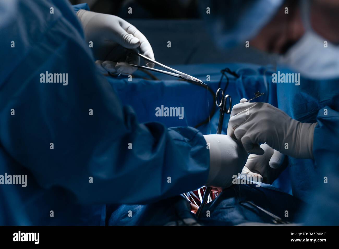 Compétences conceptuelles travailler en utilisant les dernières technologies médicales en cardiologie et transplantation. Chirurgiens, médecins travaillent pour sauver le patient Banque D'Images