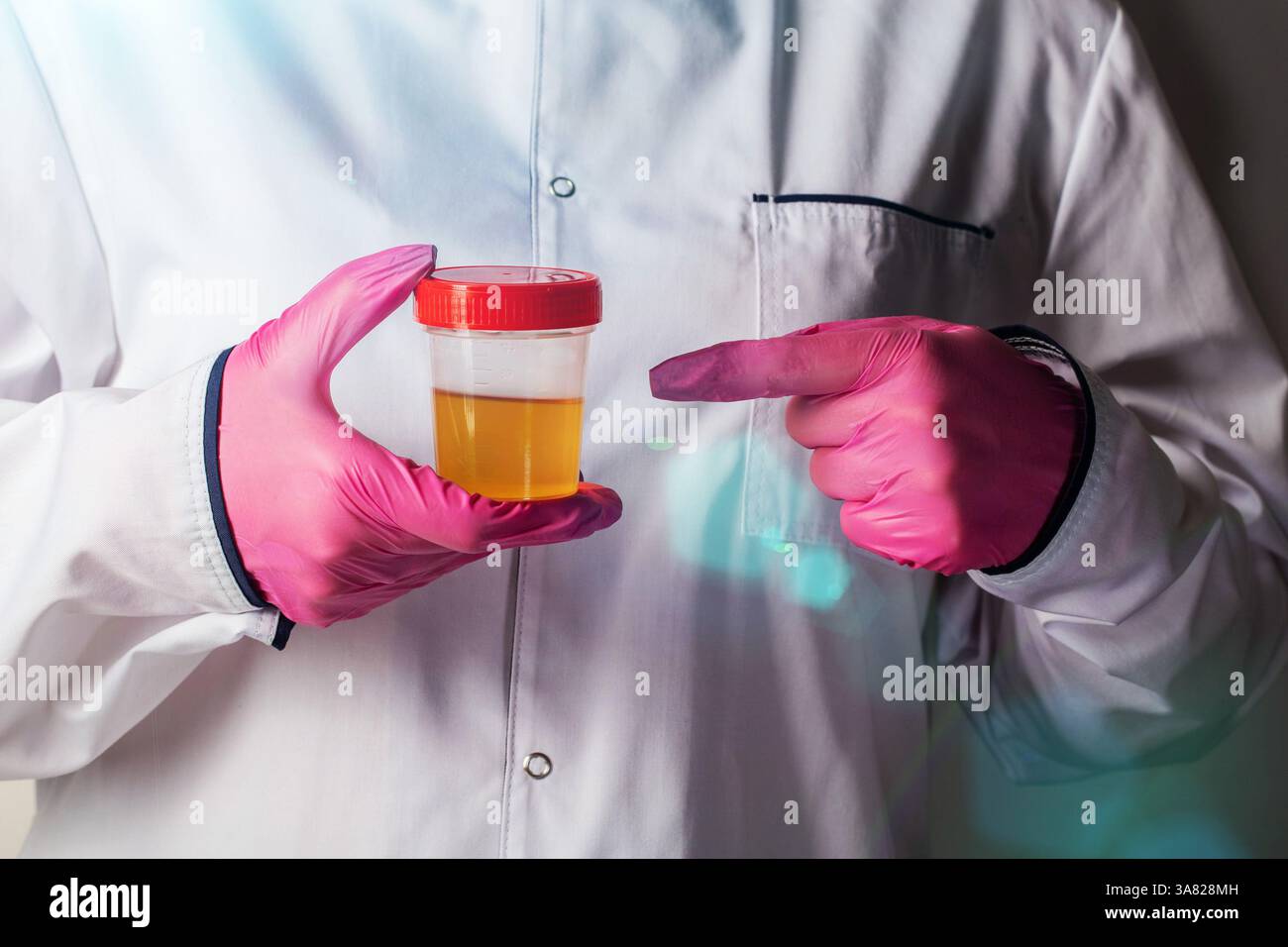 Un médecin en gants roses tient un test d'urine et pointe avec son doigt. Concept pour tester les urines pour le mucus et les infections et les maladies urologiques. Banque D'Images