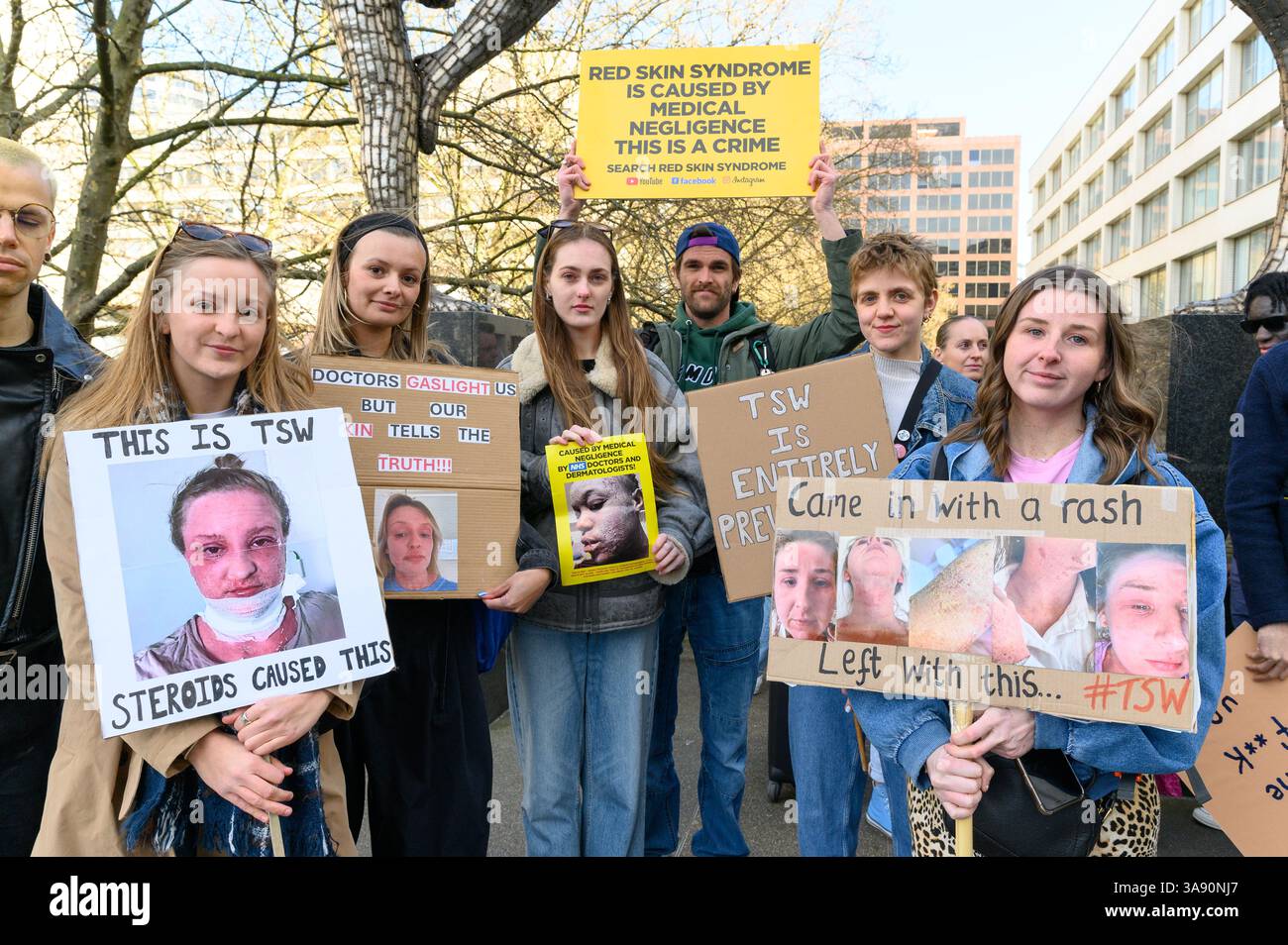 Londres, Royaume-Uni, 29 mars 2025. Les personnes qui souffrent ou ont souffert de sevrage topique des stéroïdes, également connu sous le nom de syndrome de la peau rouge, se sont rassemblées devant l’hôpital St Thomas à Londres pour protester contre les médecins et les dermatologues qui ont prescrit trop de stéroïdes pour traiter l’eczéma, causant aux patients de souffrir de TSW. Crédit : Andrea Domeniconi/Alamy Live News Banque D'Images