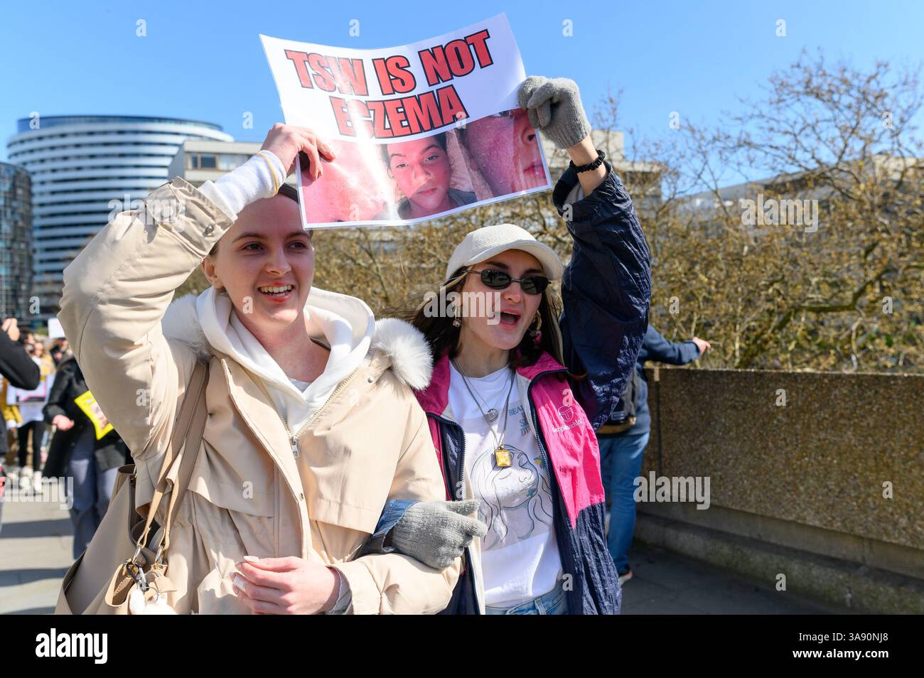 Londres, Royaume-Uni, 29 mars 2025. Les personnes qui souffrent ou ont souffert de sevrage topique des stéroïdes, également connu sous le nom de syndrome de la peau rouge, se sont rassemblées devant l’hôpital St Thomas à Londres pour protester contre les médecins et les dermatologues qui ont prescrit trop de stéroïdes pour traiter l’eczéma, causant aux patients de souffrir de TSW. Crédit : Andrea Domeniconi/Alamy Live News Banque D'Images