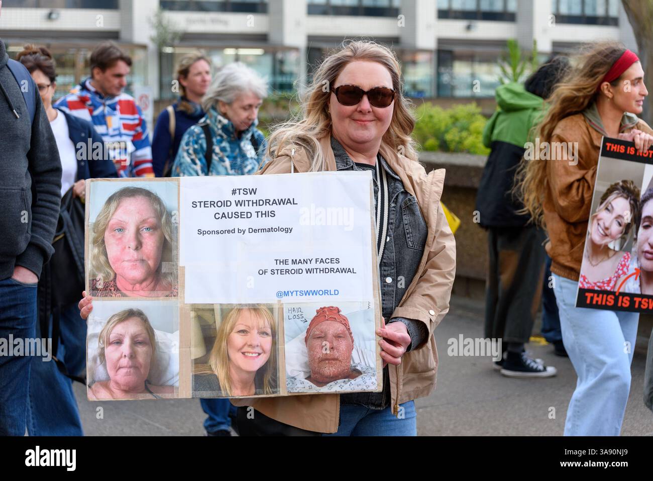 Londres, Royaume-Uni, 29 mars 2025. Les personnes qui souffrent ou ont souffert de sevrage topique des stéroïdes, également connu sous le nom de syndrome de la peau rouge, se sont rassemblées devant l’hôpital St Thomas à Londres pour protester contre les médecins et les dermatologues qui ont prescrit trop de stéroïdes pour traiter l’eczéma, causant aux patients de souffrir de TSW. Crédit : Andrea Domeniconi/Alamy Live News Banque D'Images