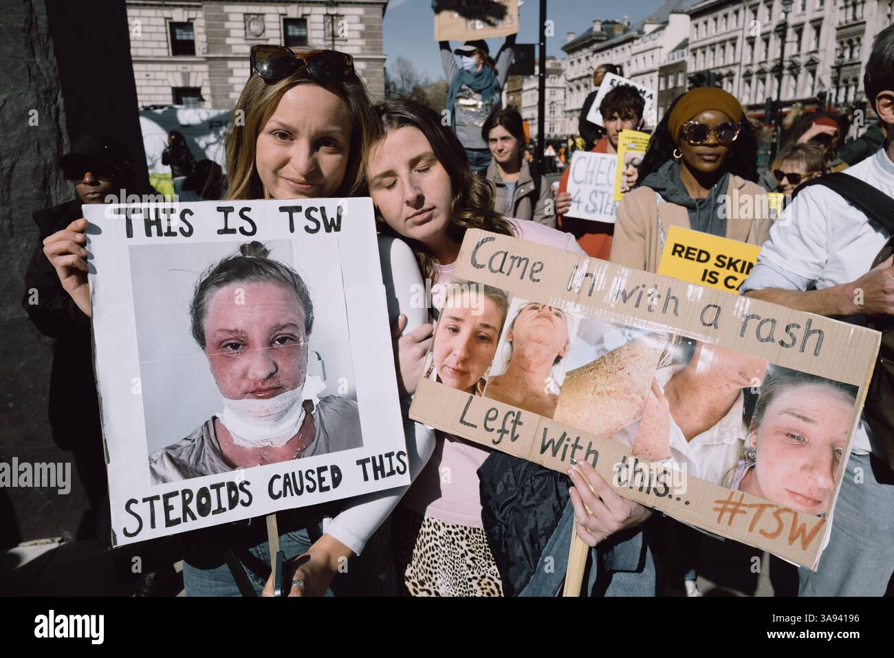 Londres, Royaume-Uni. 29 mars 2025. Un groupe de personnes touchées par le sevrage topique des stéroïdes (TSW) organise une manifestation à Parliament Square, Londres, exhortant le NHS à revoir ses protocoles de prescription des stéroïdes topiques. Les manifestants allèguent que le mauvais usage de ces traitements pour des affections comme l'eczéma a entraîné d'importantes souffrances chez les patients. Ils réclament une sensibilisation accrue et des lignes directrices plus strictes pour prévenir les effets indésirables associés à l'utilisation prolongée de stéroïdes. Crédit : Joao Daniel Pereira/Alamy Live News Banque D'Images