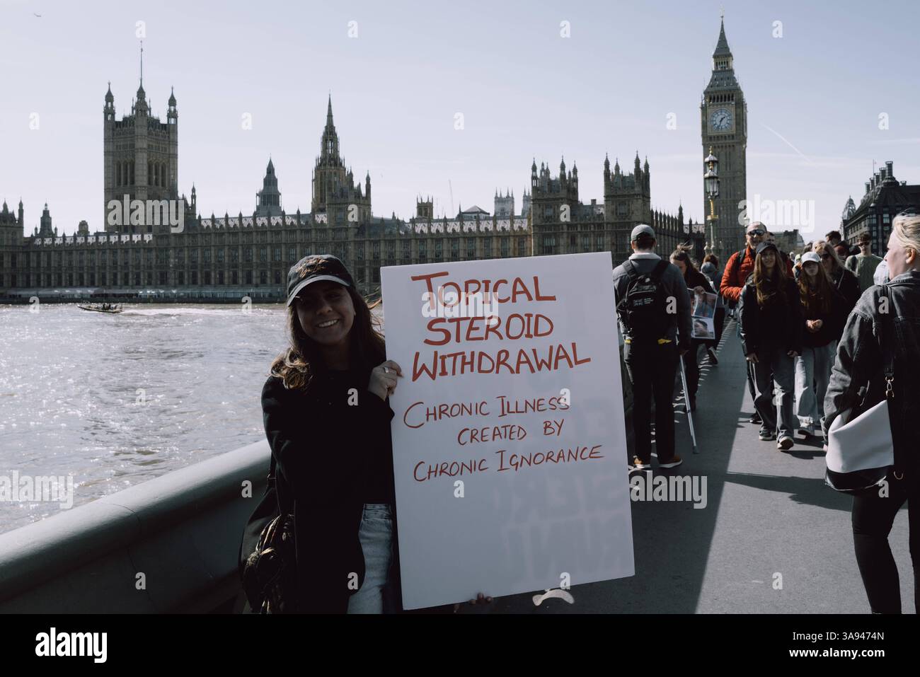 Dites non à la manifestation de stéroïdes à Londres Un groupe de personnes affectées par le retrait topique de stéroïdes TSW organise une manifestation à Parliament Square, Londres, exhortant le NHS à revoir ses protocoles de prescription pour les stéroïdes topiques. Les manifestants allèguent que le mauvais usage de ces traitements pour des affections comme l'eczéma a entraîné d'importantes souffrances chez les patients. Ils réclament une sensibilisation accrue et des lignes directrices plus strictes pour prévenir les effets indésirables associés à l'utilisation prolongée de stéroïdes. Londres Angleterre Royaume-Uni Copyright : xx Banque D'Images