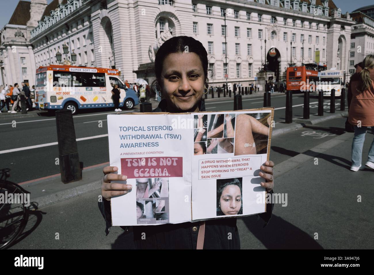 Dites non à la manifestation de stéroïdes à Londres Un groupe de personnes affectées par le retrait topique de stéroïdes TSW organise une manifestation à Parliament Square, Londres, exhortant le NHS à revoir ses protocoles de prescription pour les stéroïdes topiques. Les manifestants allèguent que le mauvais usage de ces traitements pour des affections comme l'eczéma a entraîné d'importantes souffrances chez les patients. Ils réclament une sensibilisation accrue et des lignes directrices plus strictes pour prévenir les effets indésirables associés à l'utilisation prolongée de stéroïdes. Londres Angleterre Royaume-Uni Copyright : xx Banque D'Images