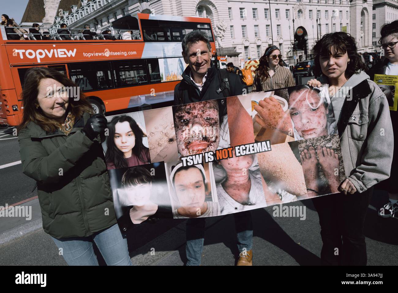 Dites non à la manifestation de stéroïdes à Londres Un groupe de personnes affectées par le retrait topique de stéroïdes TSW organise une manifestation à Parliament Square, Londres, exhortant le NHS à revoir ses protocoles de prescription pour les stéroïdes topiques. Les manifestants allèguent que le mauvais usage de ces traitements pour des affections comme l'eczéma a entraîné d'importantes souffrances chez les patients. Ils réclament une sensibilisation accrue et des lignes directrices plus strictes pour prévenir les effets indésirables associés à l'utilisation prolongée de stéroïdes. Londres Angleterre Royaume-Uni Copyright : xx Banque D'Images