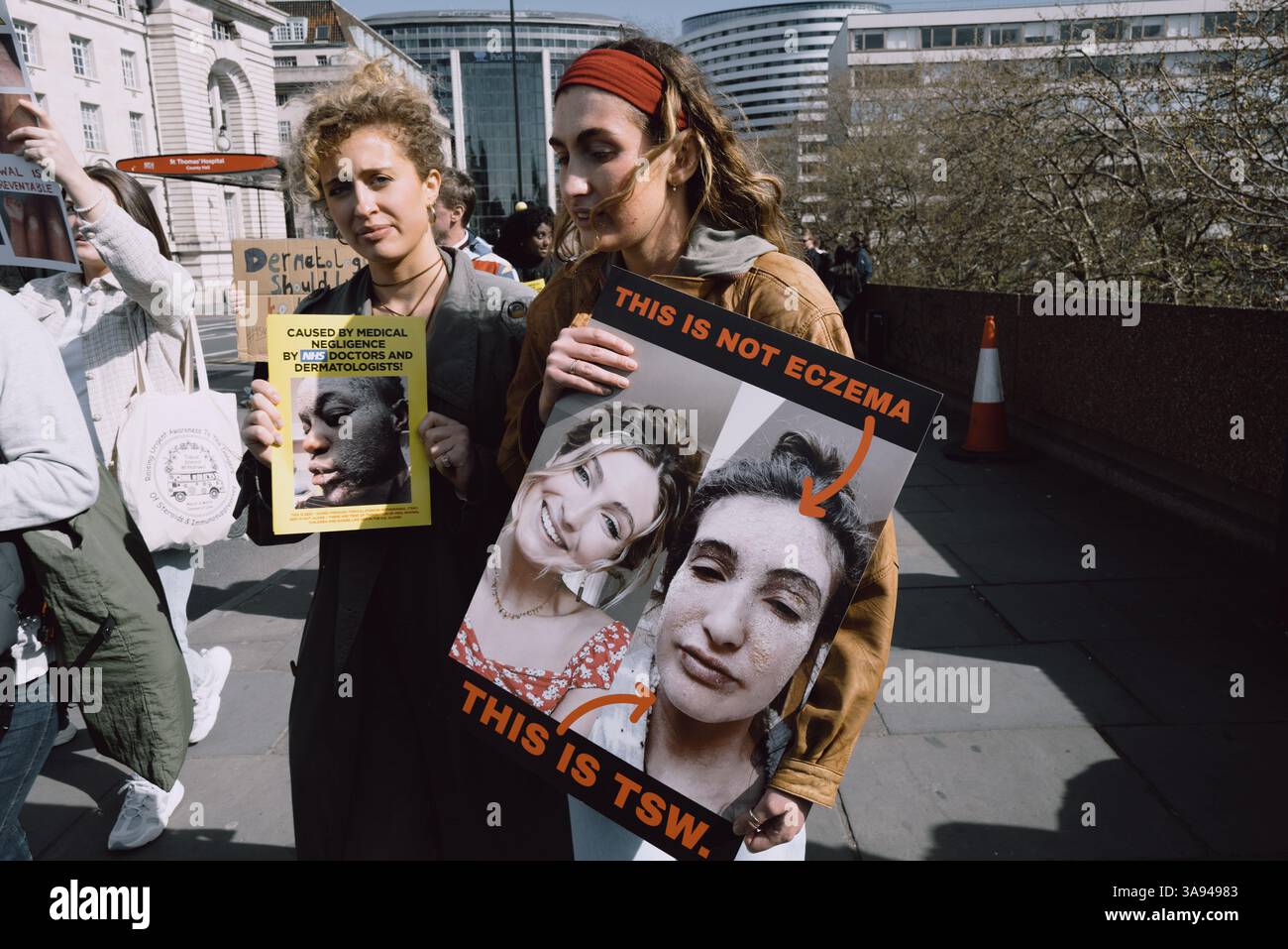 Londres, Royaume-Uni. 29 mars 2025. Un groupe de personnes touchées par le sevrage topique des stéroïdes (TSW) organise une manifestation à Parliament Square, Londres, exhortant le NHS à revoir ses protocoles de prescription des stéroïdes topiques. Les manifestants allèguent que le mauvais usage de ces traitements pour des affections comme l'eczéma a entraîné d'importantes souffrances chez les patients. Ils réclament une sensibilisation accrue et des lignes directrices plus strictes pour prévenir les effets indésirables associés à l'utilisation prolongée de stéroïdes. (Photo de Joao Daniel Pereira/Sipa USA) crédit : Sipa USA/Alamy Live News Banque D'Images