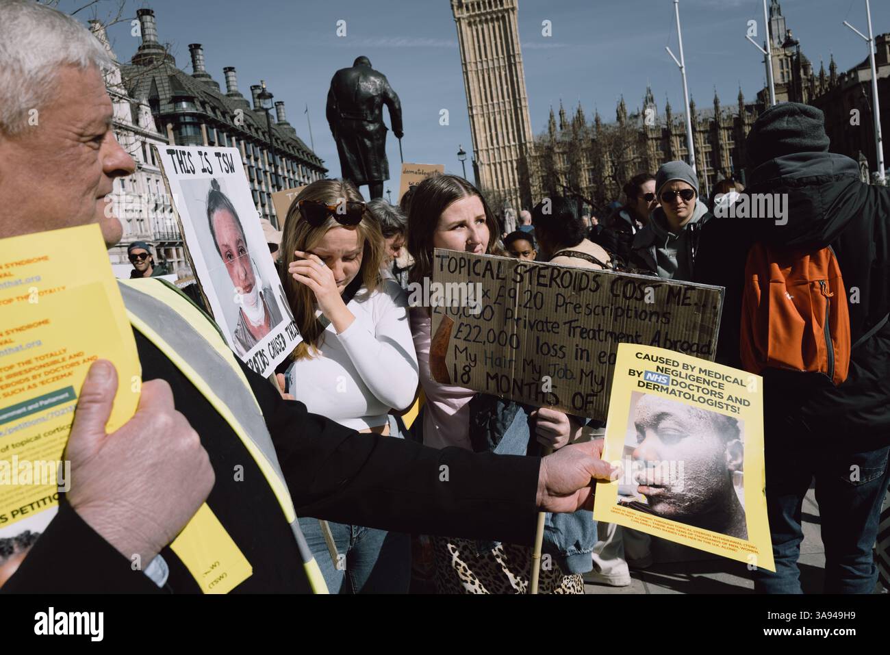 Londres, Royaume-Uni. 29 mars 2025. Un groupe de personnes touchées par le sevrage topique des stéroïdes (TSW) organise une manifestation à Parliament Square, Londres, exhortant le NHS à revoir ses protocoles de prescription des stéroïdes topiques. Les manifestants allèguent que le mauvais usage de ces traitements pour des affections comme l'eczéma a entraîné d'importantes souffrances chez les patients. Ils réclament une sensibilisation accrue et des lignes directrices plus strictes pour prévenir les effets indésirables associés à l'utilisation prolongée de stéroïdes. (Photo de Joao Daniel Pereira/Sipa USA) crédit : Sipa USA/Alamy Live News Banque D'Images