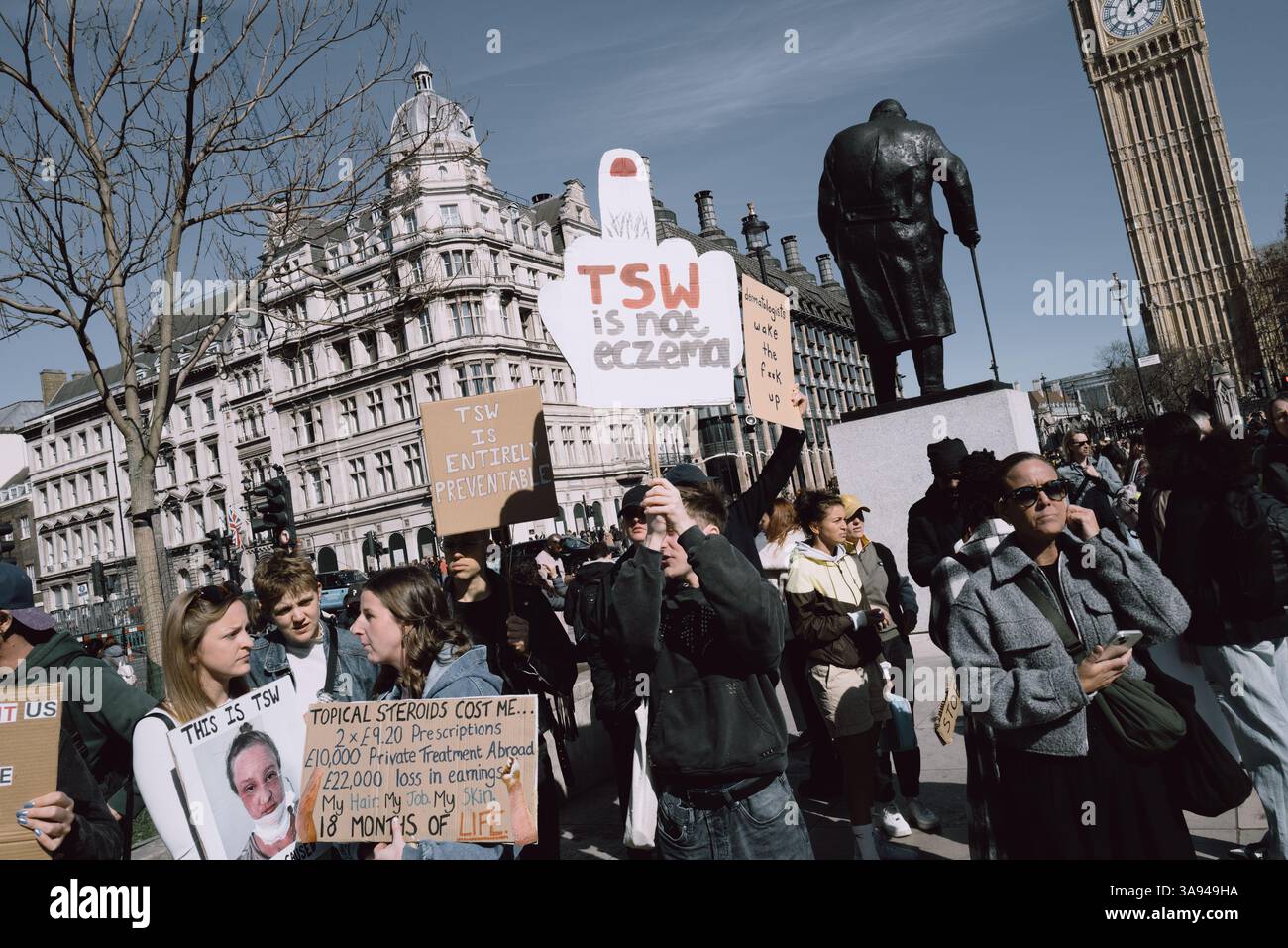 Londres, Royaume-Uni. 29 mars 2025. Un groupe de personnes touchées par le sevrage topique des stéroïdes (TSW) organise une manifestation à Parliament Square, Londres, exhortant le NHS à revoir ses protocoles de prescription des stéroïdes topiques. Les manifestants allèguent que le mauvais usage de ces traitements pour des affections comme l'eczéma a entraîné d'importantes souffrances chez les patients. Ils réclament une sensibilisation accrue et des lignes directrices plus strictes pour prévenir les effets indésirables associés à l'utilisation prolongée de stéroïdes. (Photo de Joao Daniel Pereira/Sipa USA) crédit : Sipa USA/Alamy Live News Banque D'Images