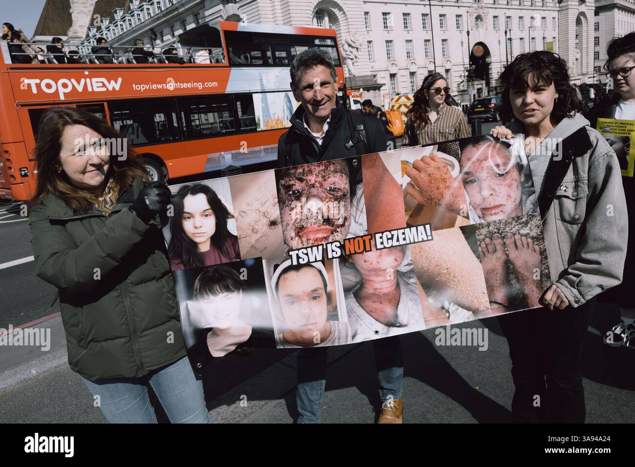 Londres, Royaume-Uni. 29 mars 2025. Un groupe de personnes touchées par le sevrage topique des stéroïdes (TSW) organise une manifestation à Parliament Square, Londres, exhortant le NHS à revoir ses protocoles de prescription des stéroïdes topiques. Les manifestants allèguent que le mauvais usage de ces traitements pour des affections comme l'eczéma a entraîné d'importantes souffrances chez les patients. Ils réclament une sensibilisation accrue et des lignes directrices plus strictes pour prévenir les effets indésirables associés à l'utilisation prolongée de stéroïdes. (Photo de Joao Daniel Pereira/Sipa USA) crédit : Sipa USA/Alamy Live News Banque D'Images