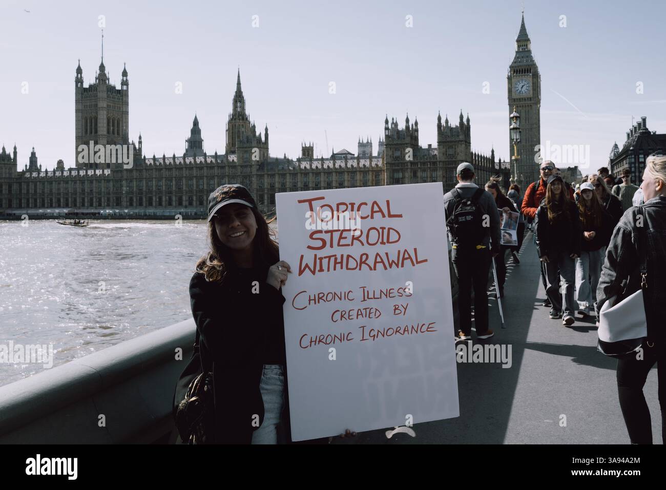 Londres, Royaume-Uni. 29 mars 2025. Un groupe de personnes touchées par le sevrage topique des stéroïdes (TSW) organise une manifestation à Parliament Square, Londres, exhortant le NHS à revoir ses protocoles de prescription des stéroïdes topiques. Les manifestants allèguent que le mauvais usage de ces traitements pour des affections comme l'eczéma a entraîné d'importantes souffrances chez les patients. Ils réclament une sensibilisation accrue et des lignes directrices plus strictes pour prévenir les effets indésirables associés à l'utilisation prolongée de stéroïdes. (Photo de Joao Daniel Pereira/Sipa USA) crédit : Sipa USA/Alamy Live News Banque D'Images
