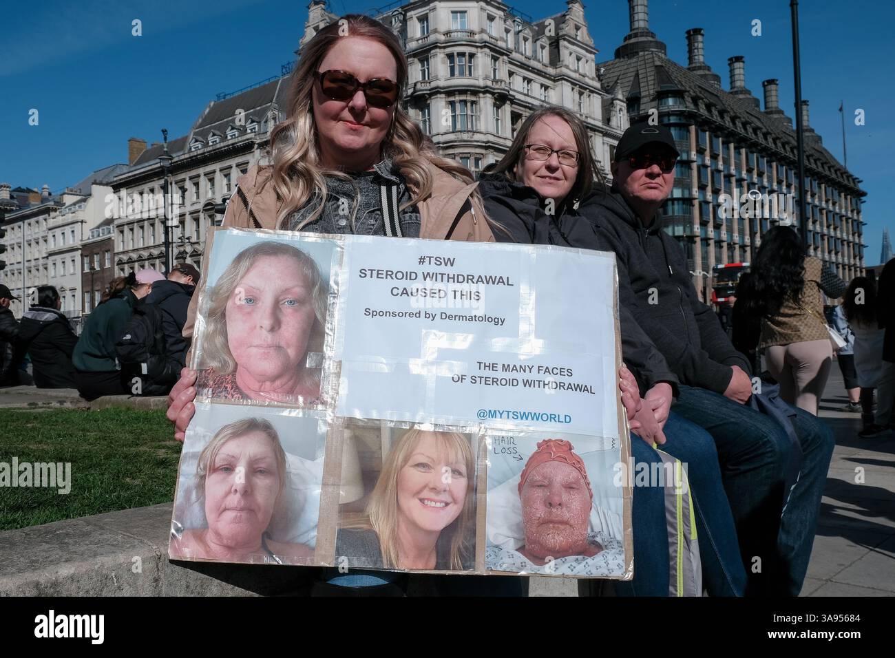 Londres, Royaume-Uni. 29 mars 2025. Les patients souffrant de troubles dématologiques aggravés par l'utilisation de corticostéroïdes topiques se sont réunis sur la place du Parlement pour partager leurs expériences personnelles et sensibiliser au processus de sevrage et de longue récupération de ces médicaments. Ils demandent au gouvernement d'examiner la disponibilité, de prescrire des protocoles et d'éduquer les patients sur les effets secondaires potentiels des médicaments. Ensuite, ils marchent vers Downing Street, déposant une pétition. Crédit : onzième heure photographie/Alamy Live News Banque D'Images