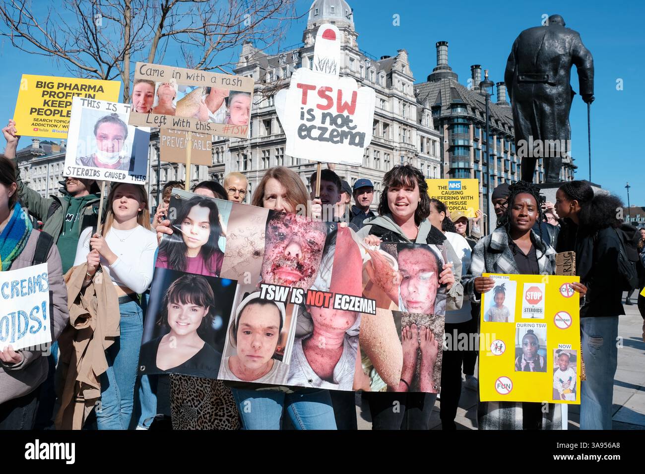 Londres, Royaume-Uni. 29 mars 2025. Les patients souffrant de troubles dématologiques aggravés par l'utilisation de corticostéroïdes topiques se sont réunis sur la place du Parlement pour partager leurs expériences personnelles et sensibiliser au processus de sevrage et de longue récupération de ces médicaments. Ils demandent au gouvernement d'examiner la disponibilité, de prescrire des protocoles et d'éduquer les patients sur les effets secondaires potentiels des médicaments. Ensuite, ils marchent vers Downing Street, déposant une pétition. Crédit : onzième heure photographie/Alamy Live News Banque D'Images