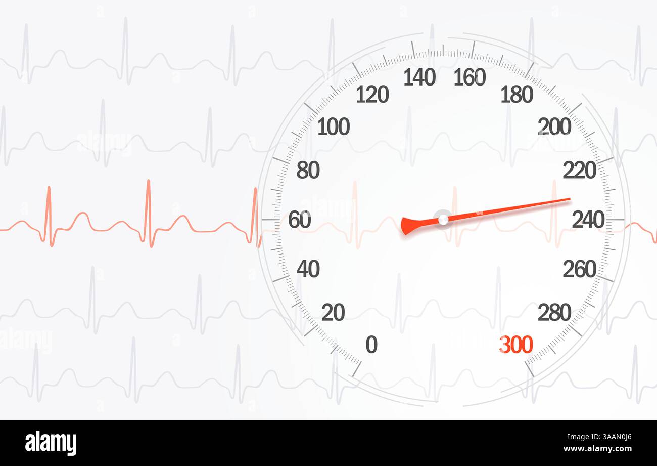 Taux élevé de pression artérielle sur le fond des lignes de cardiogramme, image vectorielle. Illustration de Vecteur