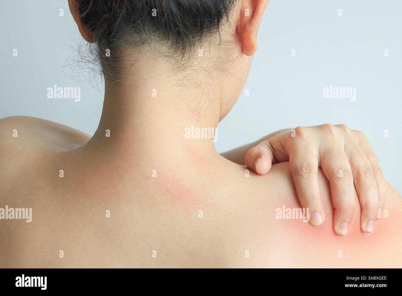 Femmes avec douleur à l'épaule ou syndrome de bureau, concept de santé Banque D'Images