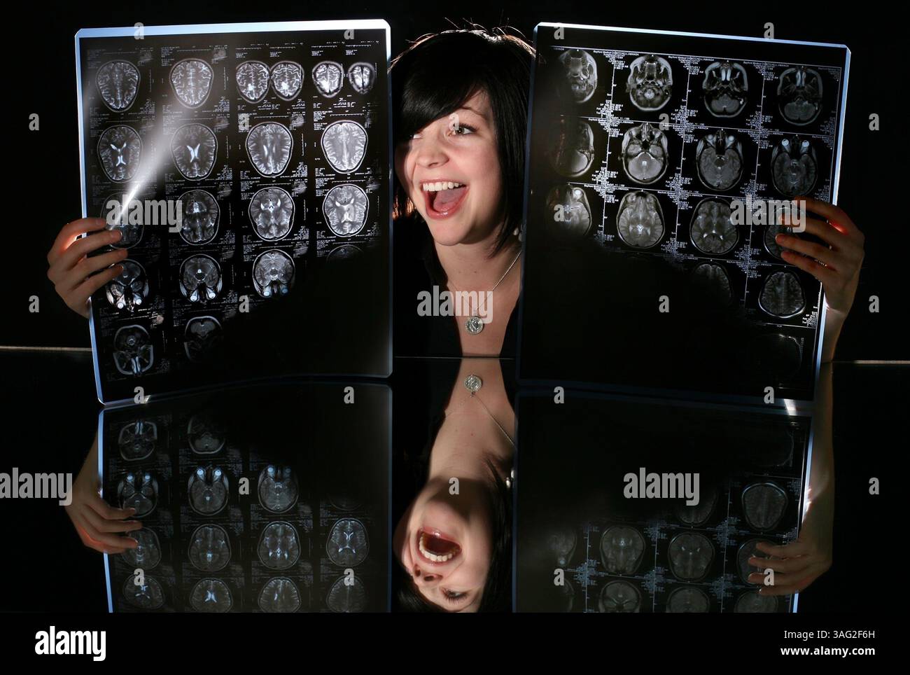 12 mai 2008 - Petersburg, Florida, USA - AMANDA MITCHELL, 23 ans, pose avec des scans de son cerveau dans le studio Times lundi 12 mai. 2008. Mitchell s'est fait enlever une tumeur cérébrale à l'âge de 18 ans (Credit image : St Petersburg Times/ZUMAPRESS.com) Banque D'Images