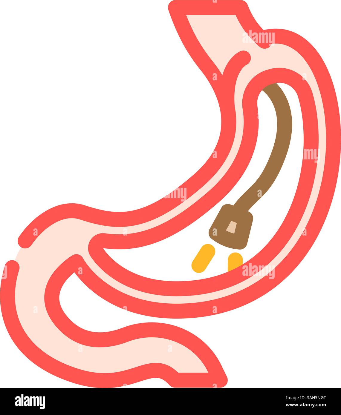 procédure de gastroscopie illustration vectorielle couleur gastroentérologue Illustration de Vecteur
