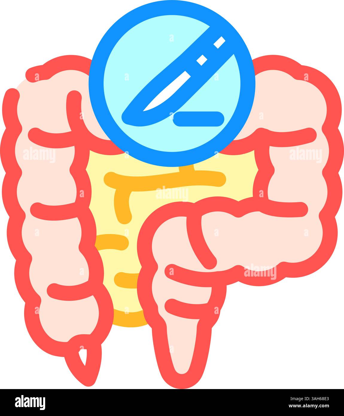 illustration vectorielle d'icône couleur de chirurgie gastro-intestinale Illustration de Vecteur