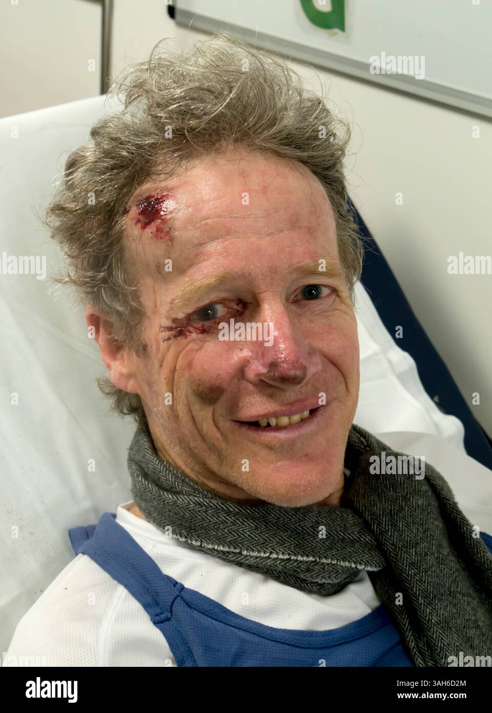Traumatisme patient blessé accident de bicyclette rire Banque D'Images