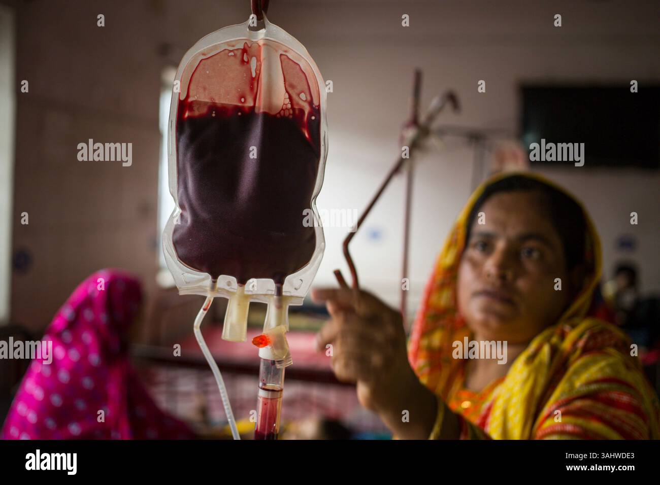 10 oct. 2016 - Dhaka, Bangladesh - la mère d'Une patiente de thalassémie prépare une poche de sang pour transfusion au centre de thalassémie de l'hôpital pour enfants de Dhaka. Dans la thalassémie, il y a un défaut dans la production d'hémoglobine conduisant à l'anémie. Afin de corriger l'anémie, une transfusion sanguine régulière est nécessaire. Parfois, un patient majeur de thalassée doit prendre 3/4 sac en un mois. (Crédit image : © Noor Alam via ZUMA Wire) Banque D'Images