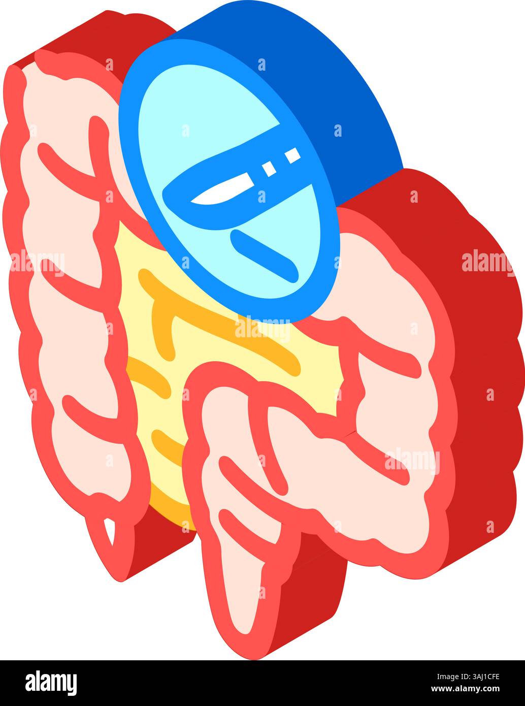 illustration vectorielle d'icône isométrique de chirurgie gastro-intestinale Illustration de Vecteur