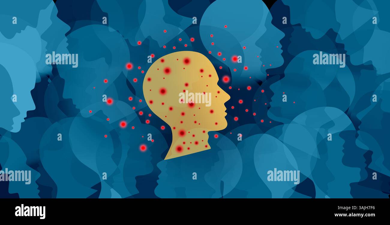 Épidémie de rougeole comme une maladie très contagieuse concept médical en tant que personne avec une infection virale se propageant comme Koplik taches. Banque D'Images Épidémie de rougeole comme une maladie très contagieuse concept médical en tant que personne avec une infection virale se propageant comme Koplik taches. Banque D'Images