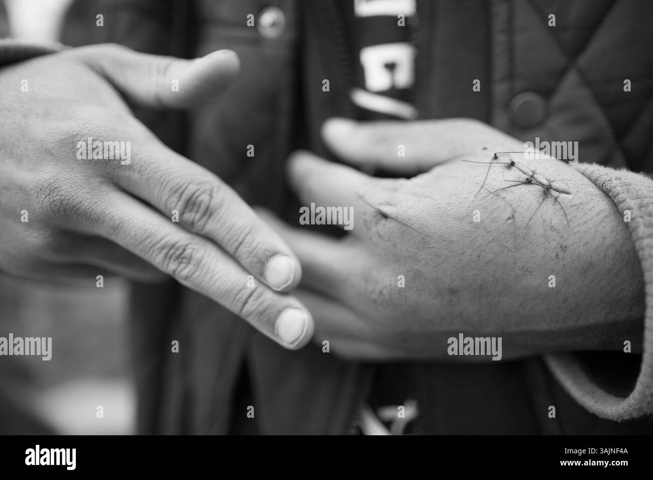 APR 27, 2014 - Brooklyn, New York, États-Unis - BLASK s'est fait couper la main avec une bouteille cassée lors d'un combat avec des membres d'un gang ennemi appelé les Trinitarios, ce genre de blessures sont fréquentes entre les membres du gang depuis les combats dégénèrent rapidement des poings aux lames de rasoir, couteaux et armes à feu. (Crédit image : © Nicolas Enriquez/zReportage.com via ZUMA Wire) Banque D'Images