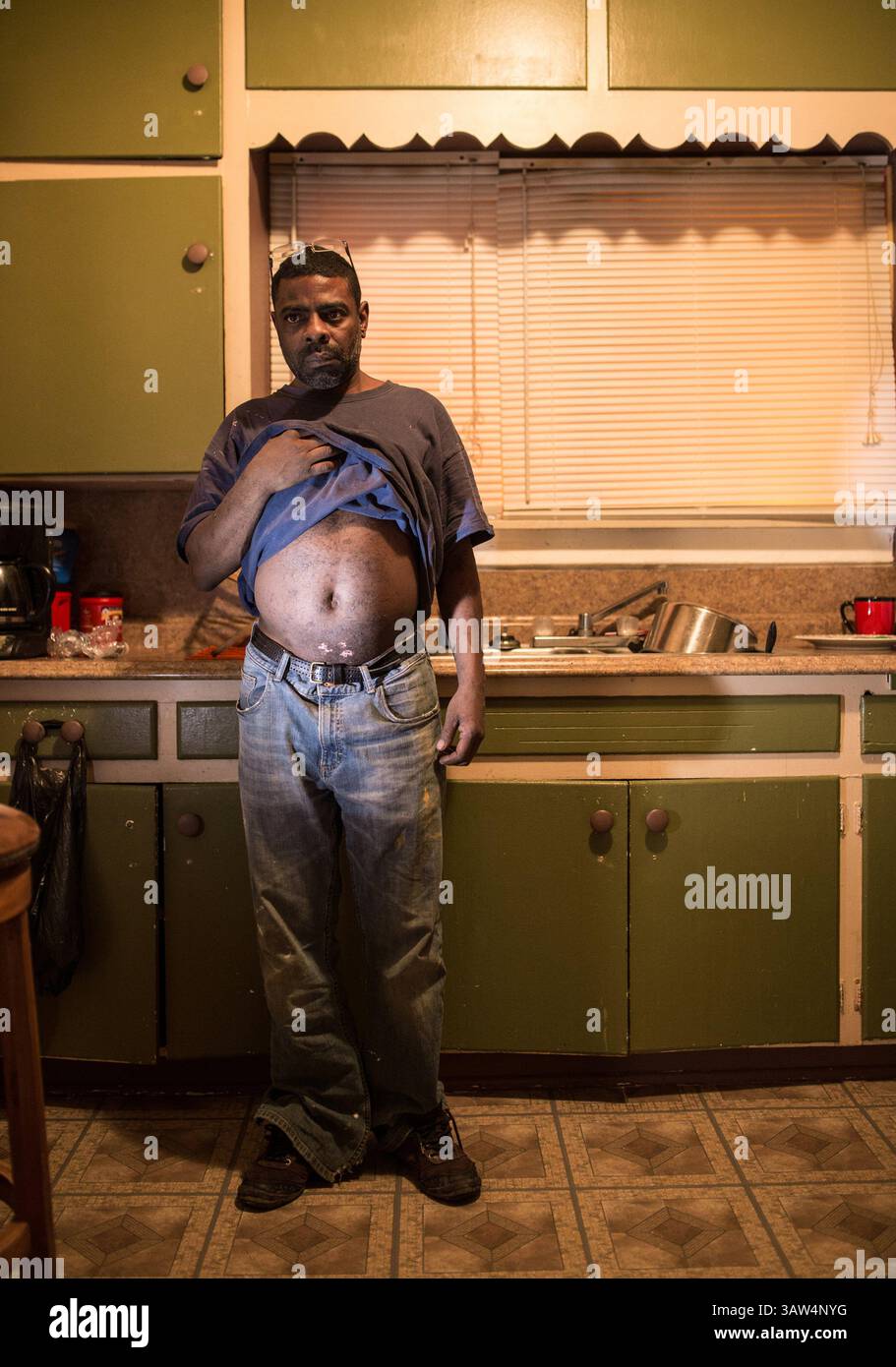Février 5, 2016 - Flint, mi, USA - ''ils ne sont pas partis dire rien. Vous en avez eu qui se plaignaient et puis vous en avez beaucoup qui continuaient à avancer. Regarde mon corps. J'ai dû dire quelque chose. Je vais exprimer mon opinion chaque fois que j'en aurai l'occasion. Chaque fois que j'ai l'occasion de dire quelque chose,'' a déclaré Darryl Wilson, résident de Flint, 46 ans, en montrant l'éruption cutanée sur son ventre et ses bras à sa maison sur le côté nord de Flint le 5 février 2016. ''si j'étais venu dans votre communauté et que j'avais blessé quelque chose ou fait quelque chose de vandalisé quelque chose, vous m'en tiendriez responsable. (Crédit image : © Ry Banque D'Images