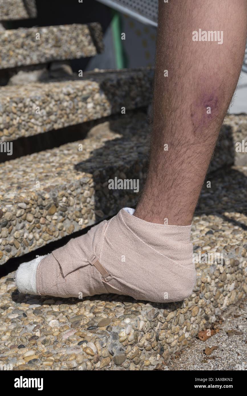 Blessure au pied droit et à l'orteil blessure, bandages - gros plan Banque D'Images