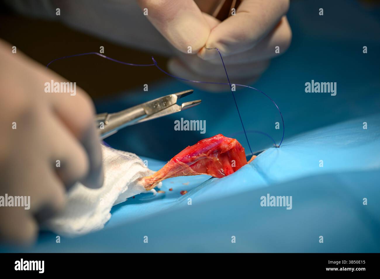 Un vétérinaire en piquant les plaies sur une jambe d'une caille commune ou européenne, (Coturnix coturnix), photographiée à l'Israel Wildlife H Banque D'Images
