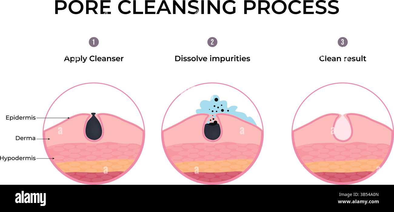 Illustration vectorielle du processus de nettoyage des pores Illustration de Vecteur