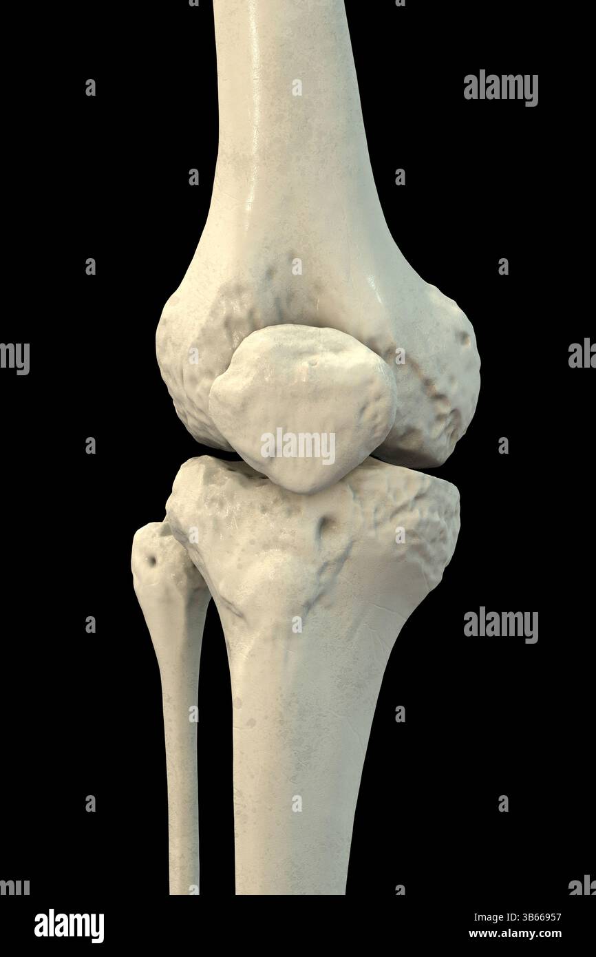 Illustration de l'anatomie des os du genou, représentant le fémur, le tibia, le péroné et la rotule. Banque D'Images
