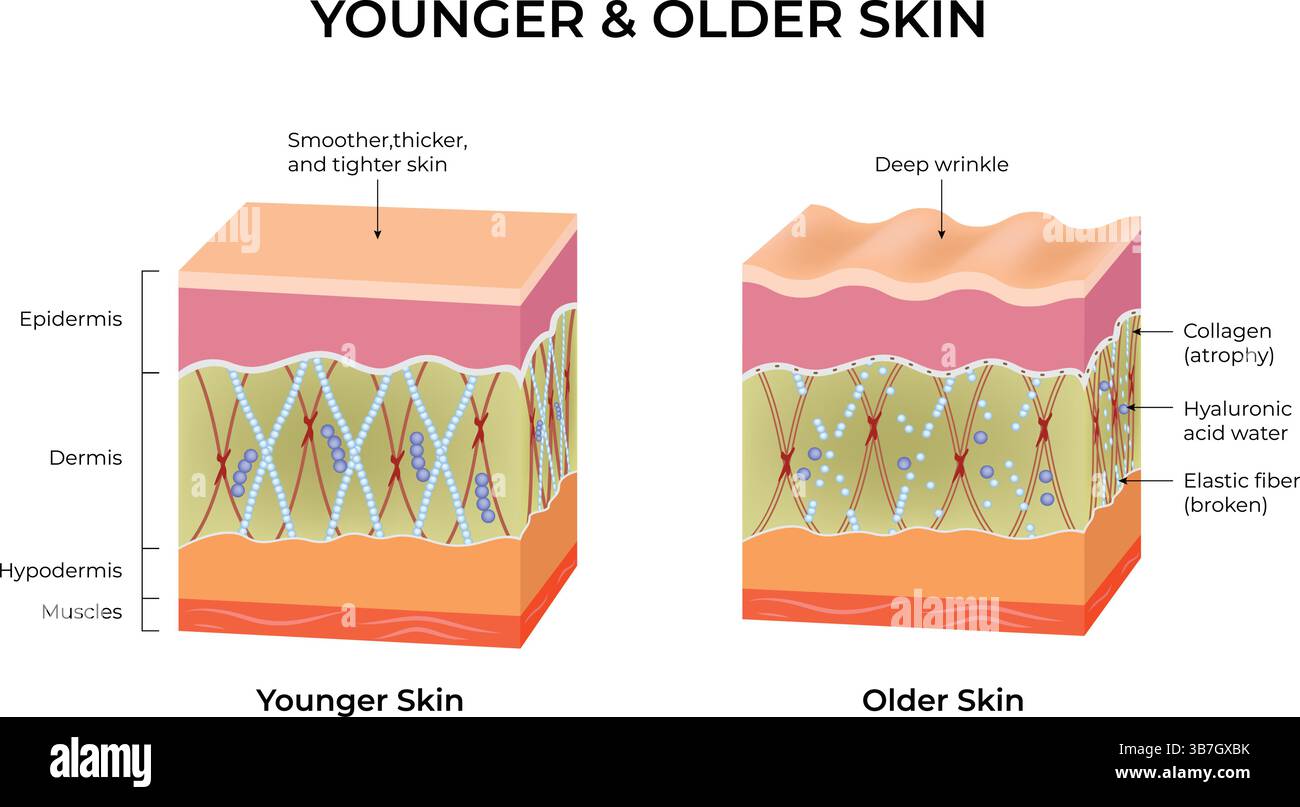 Peau plus jeune et peau plus âgée : comparaison de la structure de la peau et de l'illustration vectorielle du vieillissement Illustration de Vecteur