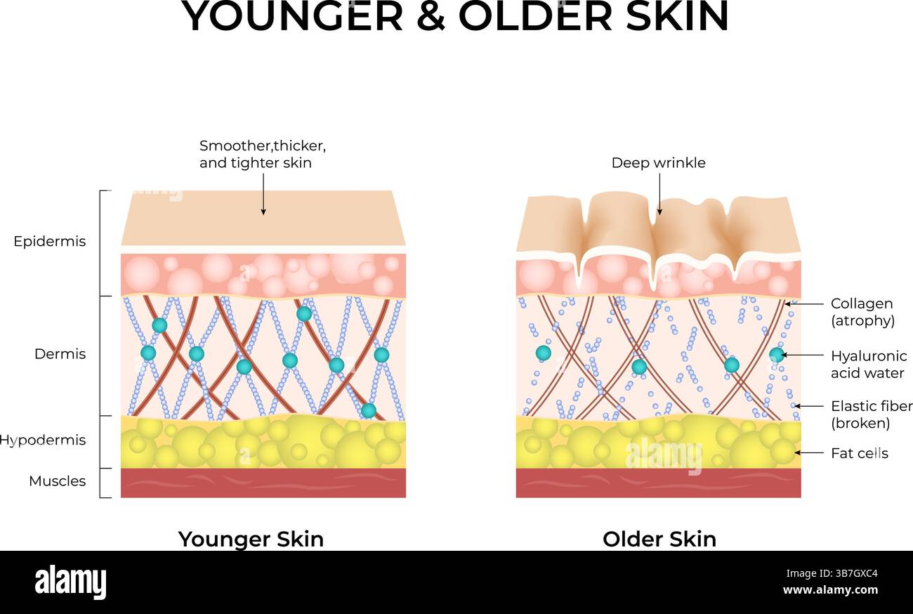 Peau plus jeune et peau plus âgée : comparaison de la structure de la peau et de l'illustration vectorielle du vieillissement Illustration de Vecteur