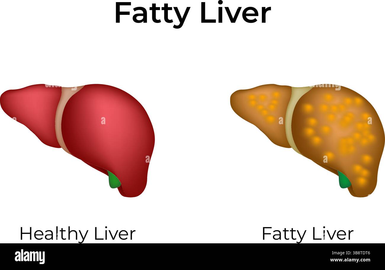 Foie gras vs foie sain illustration vectorielle de conception Illustration de Vecteur