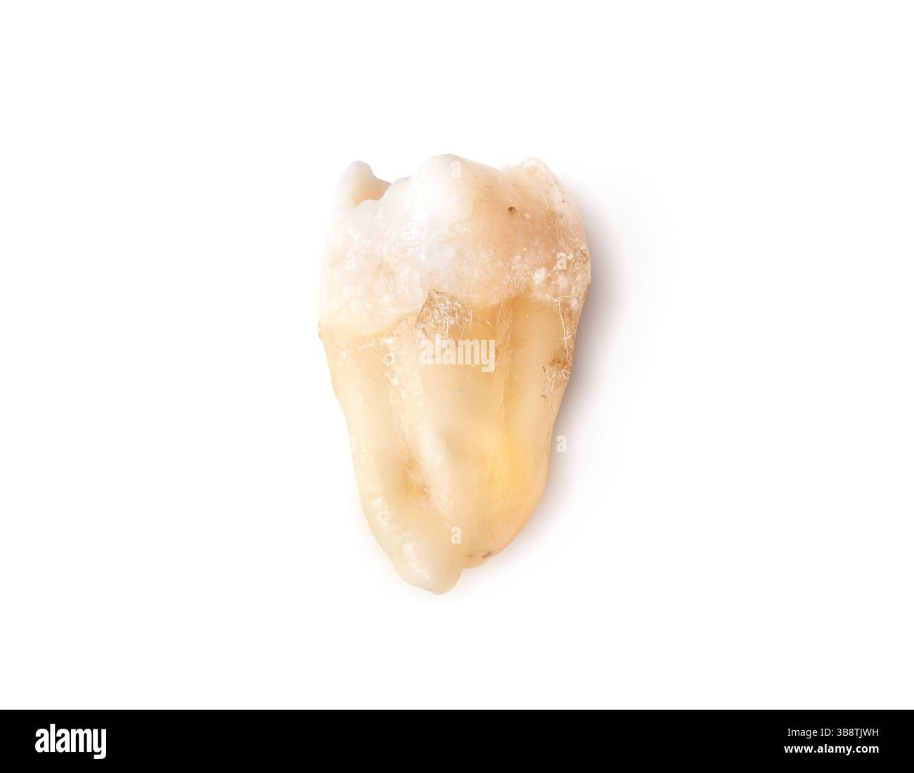 Dent de sagesse isolée après extraction. Véritable trou dent de sagesse ou troisième molaire avec racine et couronne visibles. Soins dentaires ou anatomie clinique se référer Banque D'Images