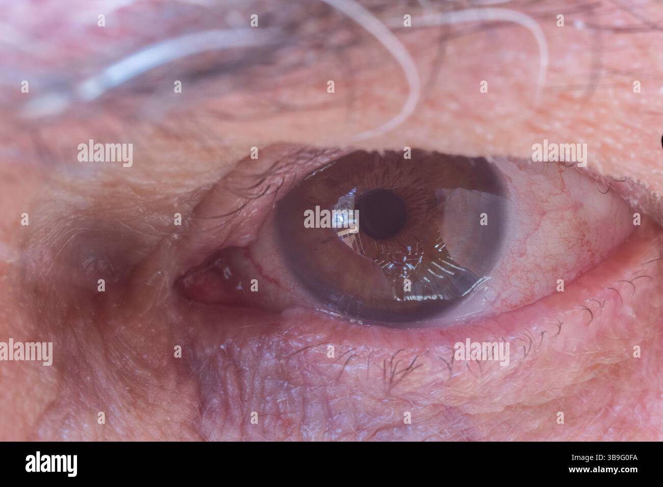 yeux bruns avec des vignes de sang dans le blanc Banque D'Images