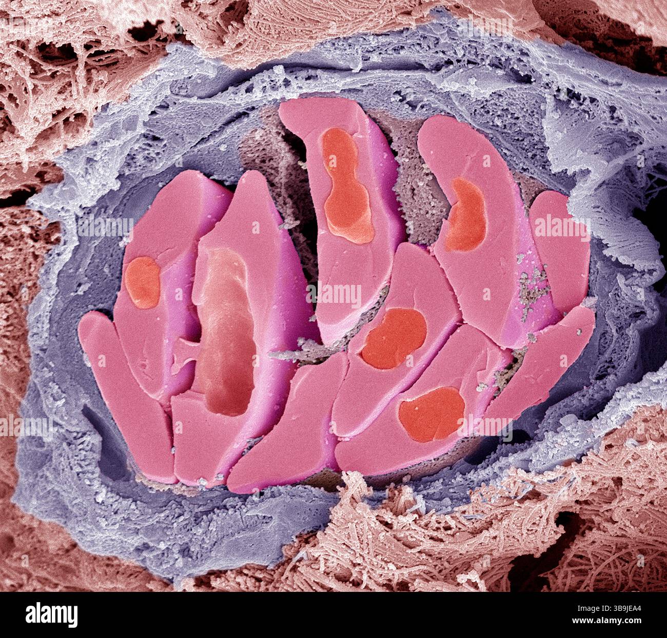 Globules rouges d'oiseau. Micrographie électronique à balayage couleur (MEB) des globules rouges fracturés (érythrocytes, rouges) dans un vaisseau sanguin aviaire. Ces cellules contiennent de l'hémoglobine, un pigment qui leur permet de transporter l'oxygène dans tout le corps. Les globules rouges non mammaliens (tels que ceux-ci) sont de forme ovale (discoïde) et contiennent un noyau cellulaire. Les globules rouges humains sont en forme de disque et ne possèdent pas de noyau cellulaire. La fibrine (utilisée dans la coagulation du sang) peut être observée entre les cellules. Le tissu conjonctif entoure le vaisseau sanguin. Grossissement : x4000 lors de l'impression de 10 centimètres de large. Banque D'Images