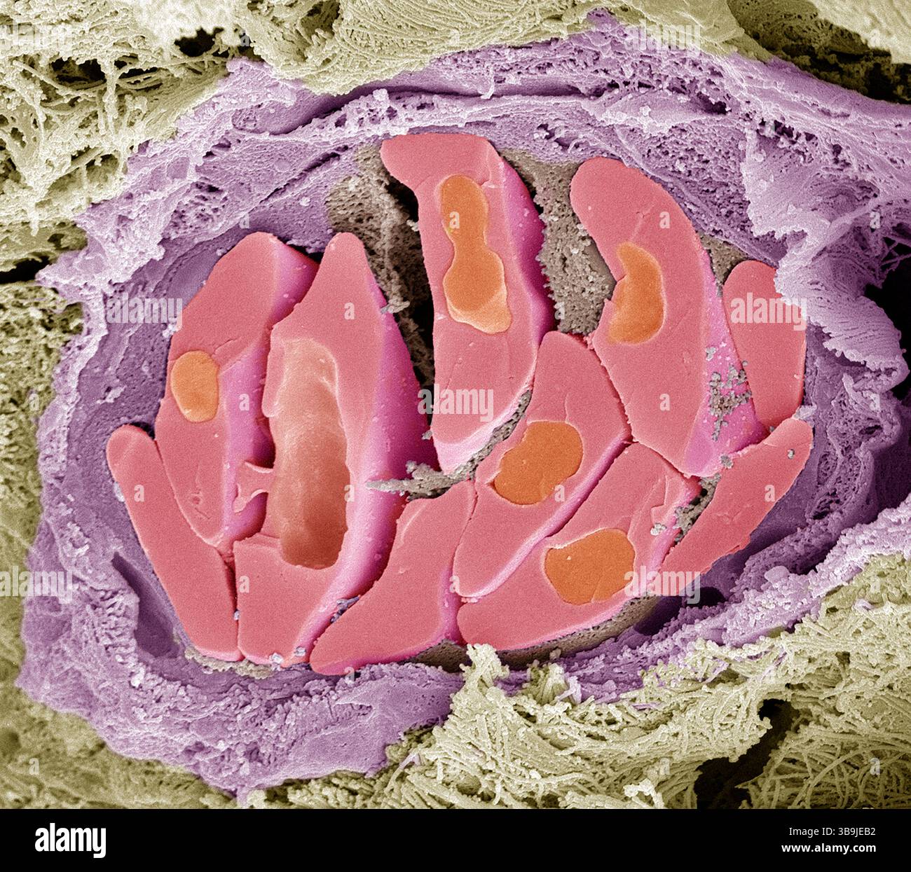 Globules rouges d'oiseau. Micrographie électronique à balayage couleur (MEB) des globules rouges fracturés (érythrocytes, rouges) dans un vaisseau sanguin aviaire. Ces cellules contiennent de l'hémoglobine, un pigment qui leur permet de transporter l'oxygène dans tout le corps. Les globules rouges non mammaliens (tels que ceux-ci) sont de forme ovale (discoïde) et contiennent un noyau cellulaire. Les globules rouges humains sont en forme de disque et ne possèdent pas de noyau cellulaire. La fibrine (utilisée dans la coagulation du sang) peut être observée entre les cellules. Le tissu conjonctif entoure le vaisseau sanguin. Grossissement : x4000 lors de l'impression de 10 centimètres de large. Banque D'Images