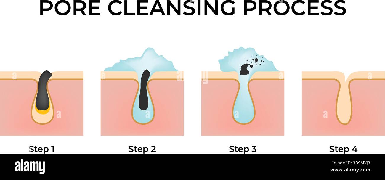 Processus de nettoyage des pores : une illustration vectorielle de conception de guide étape par étape Illustration de Vecteur