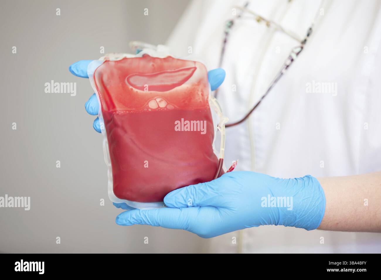 Le plasma sanguin au centre de la transfusionnologie et du don. fermez la poche de sang dans le laboratoire dans les mains Banque D'Images