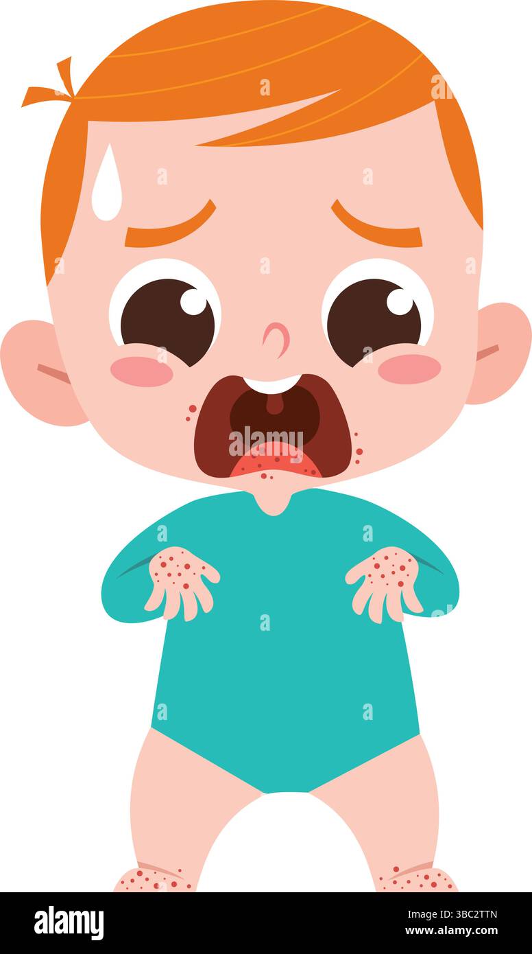 Pleurs de bébé avec éruption cutanée – illustration caricaturale de réaction allergique ou de maladie main-pied-bouche Illustration de Vecteur