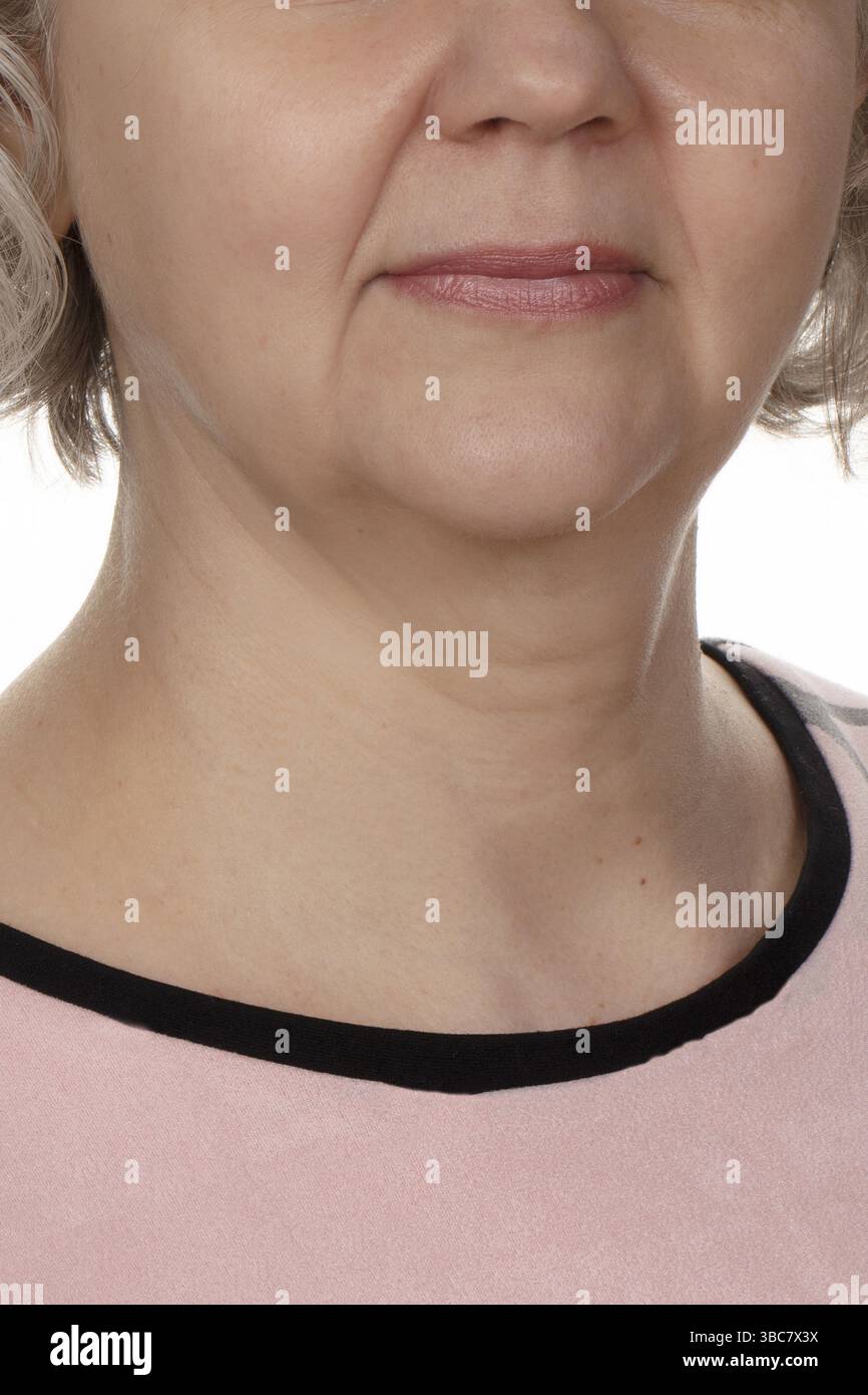 La moitié inférieure du visage d'une femme plus âgée après cinquante ans, avec des changements et des rides prononcés liés à l'âge Banque D'Images