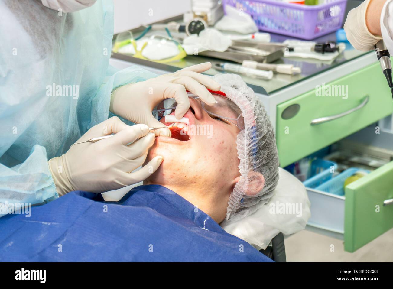 Un professionnel dentaire effectue une procédure de nettoyage sur un patient pour éliminer la plaque dentaire, assurant la santé dentaire et la blancheur des dents Banque D'Images